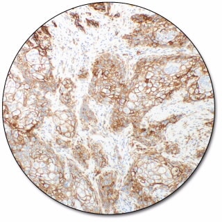 PD-L1 IHC 28-8 pharmDx for Autostainer Link 48